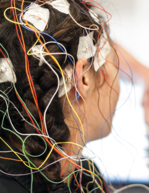 Patient wearing EEG electrodes during a brain assessment